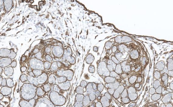 fibroblast progenitor cells