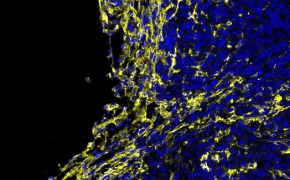 fibroblast progenitor cells