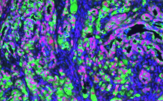 fibroblast progenitor cells