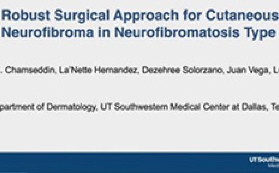 video of surgical removal of cNF