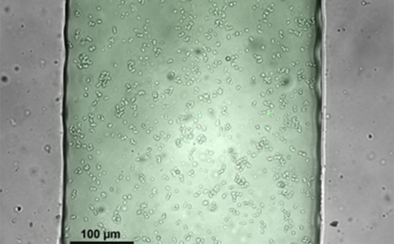 light green and gray micrograph