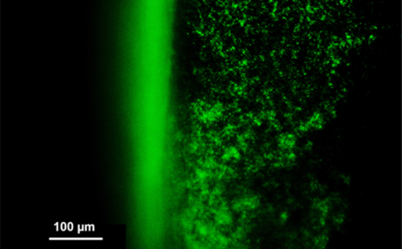 green and black biofilm with micron measurement