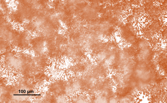 orange and white micrograph