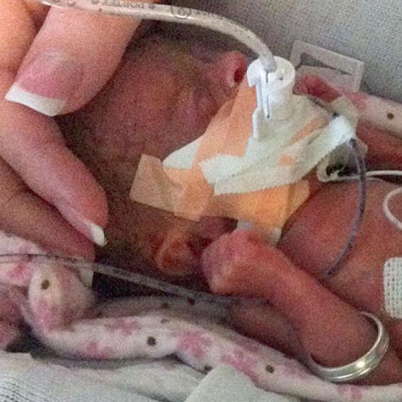 Premature baby with woman's hand cradling its head
