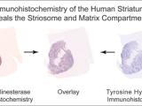 Human Striatum