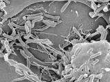 Bacteria on microscope slides