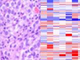 Seminoma superimposed on copy number array data