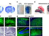 Fig. 5: NMDA and AAV-ICV injection in vivo