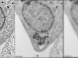 Poxvirus Pathogenesis sections