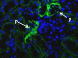 Klotho Immunofluoresence IF representation of Klotho (green) strongly expressed in the distal convoluted tubule and weakly in proximal tubules. Cyto16 (blue)
