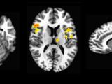 Individuals with ASD show reduced neurological activation during an fMRI visuomotor task