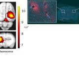 Nanoparticle Delivery to Brain comparisons