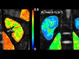 Oxygen-enhanced MRI of human organs