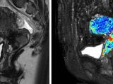 Oxygen-enhanced MRI of human sagittal section