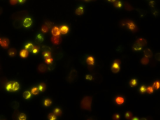 Ion channel and membrane receptor clusters