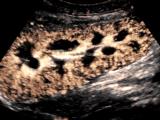 Contrast of 3 slides: A Revolution in Ultrasound