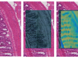 Raman tissue mapping