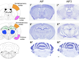 AIF3 splicing switch triggers neurodegeneration
