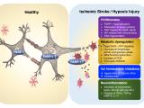 Multifaceted effects of PARP-1 activation on neuron and microglia following ischemia/hypoxia