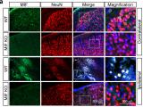 MIF promotes neurodegeneration and cell death via its nuclease activity following traumatic brain injury