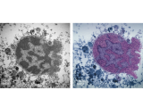 NMDA_Chromatin condensation