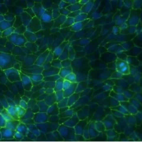 Immunofluorescent staining of airway epithelial cells grown at air-surface liquid.