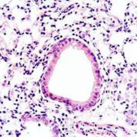 Histology of lungs from our mouse model of Pseudomonas aeruginosa infection.