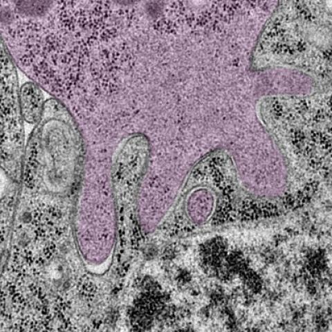 Electron micrograph showing Mechanical stress