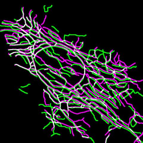 filament dynamics in a keratinocyte