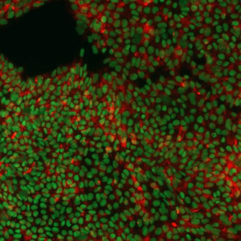 Immunofluorescence image of hiPSCs stained for pluripotency markers SOX2 (green) and TRA-1-60 (red).